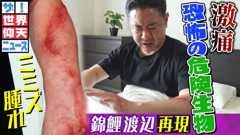 【世界仰天ニュース】夏に要注意のやけど虫!触れただけで激痛に!?注意点と対処法は?【錦鯉 渡辺隆×杉原凛】
