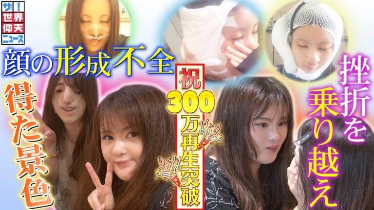 【ザ!世界仰天ニュース】「普通の顔になりたい」挫折を乗り越えた今の景色